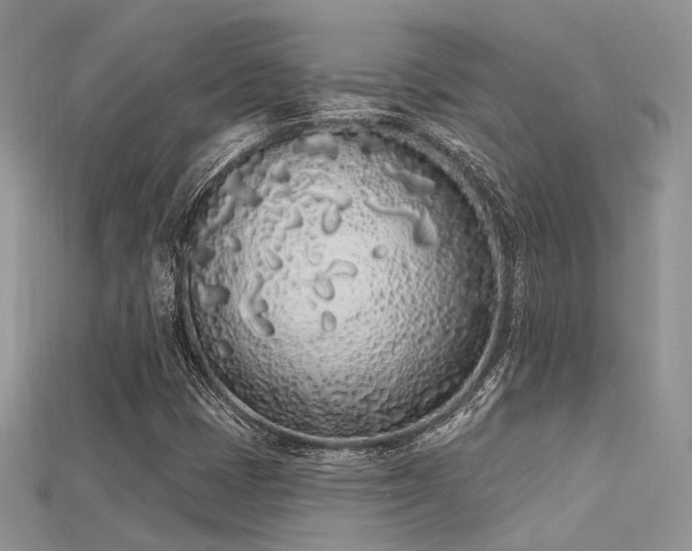 X0000115711401200911121415