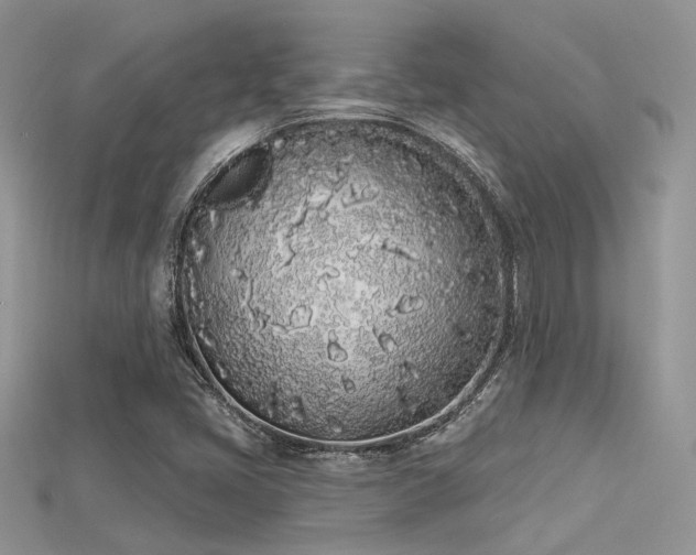 X0000115711405200911121415