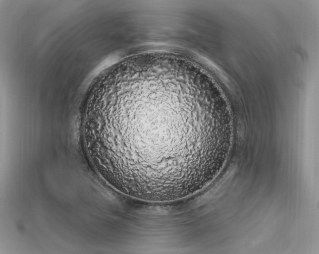 X0000115711411200911121416