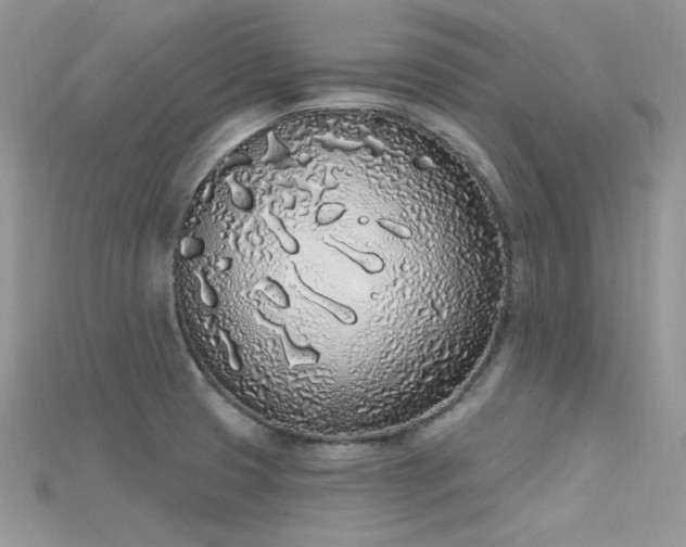 X0000115711425200911121416