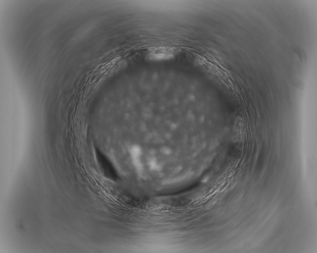 X0000115711441200911121415