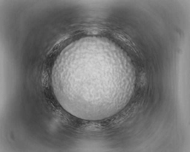 X0000115711446200911121415