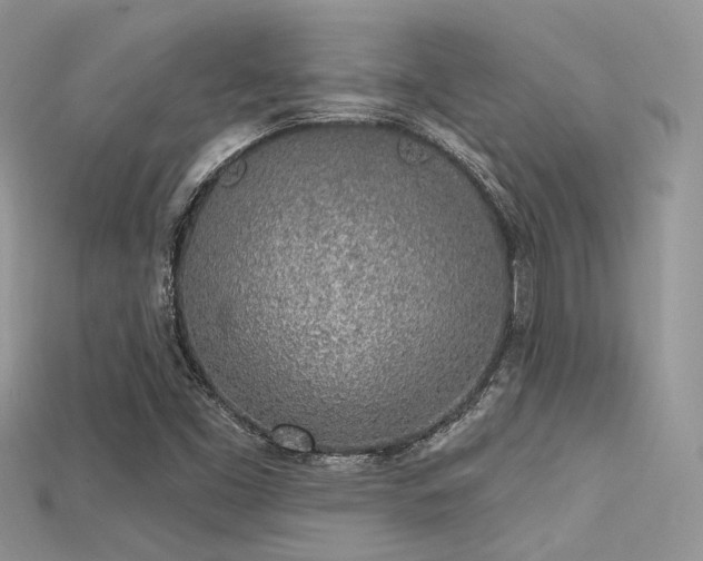 X0000115711453200911121415