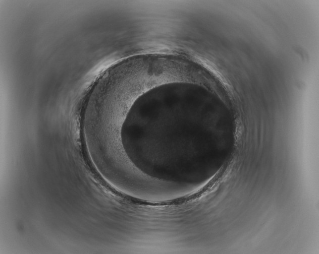 X0000115711455200911121415