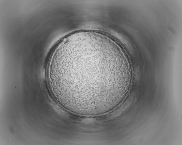 X0000115711462200911121415