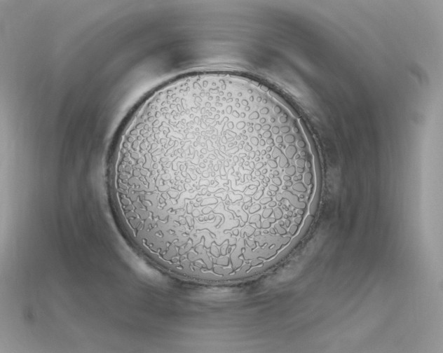 X0000115711470200911121415