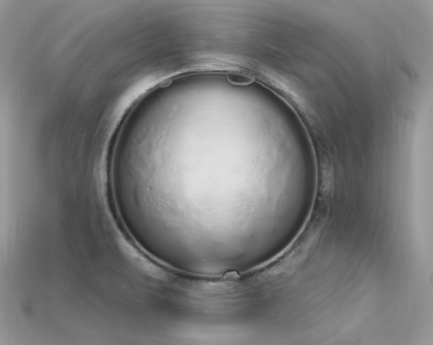 X0000115711471200911121415