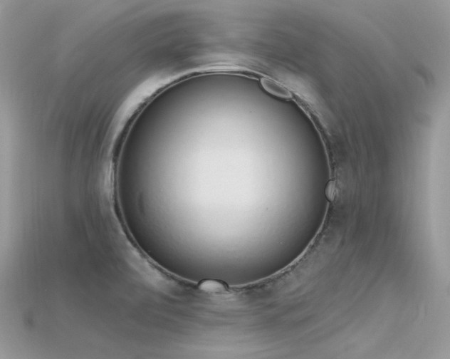 X0000115711472200911121415