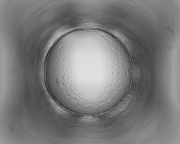 X0000115711478200911121415