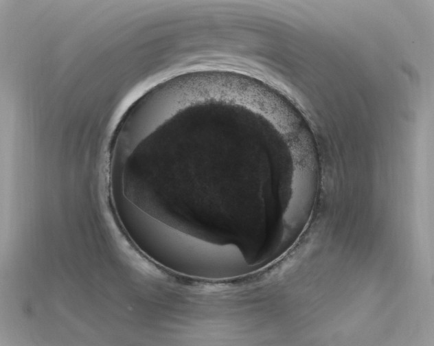 X0000115711522200911121415