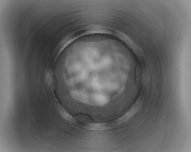 X0000115711369200911191241