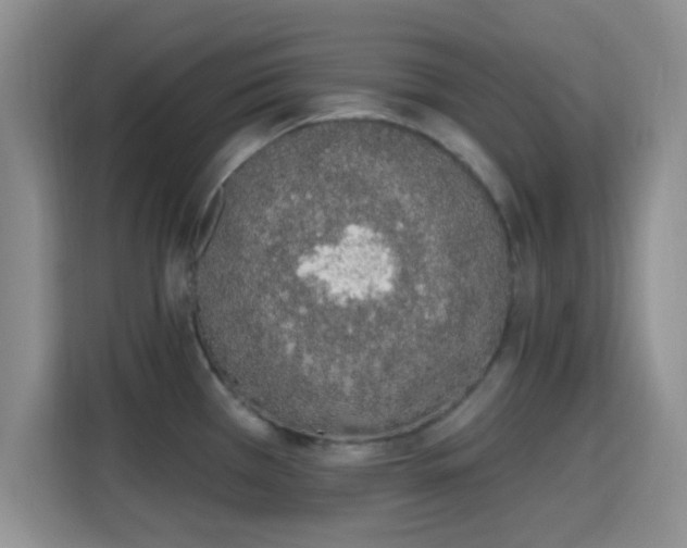 X0000115711385200911191241