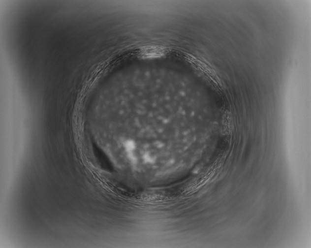 X0000115711441200911191240