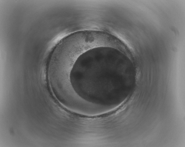 X0000115711455200911251845