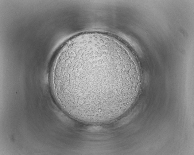 X0000115711462200911251845