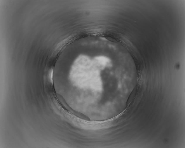 X0000115710047200912031538