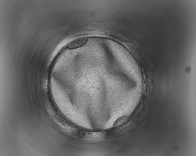 X0000115710056200912031537