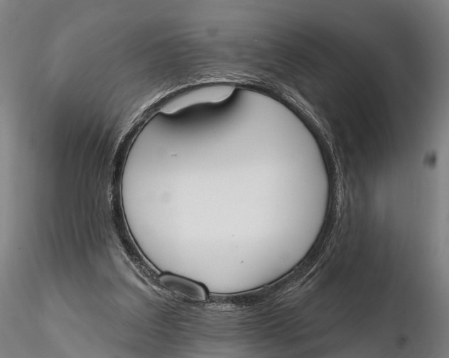 X0000115710203200912031535