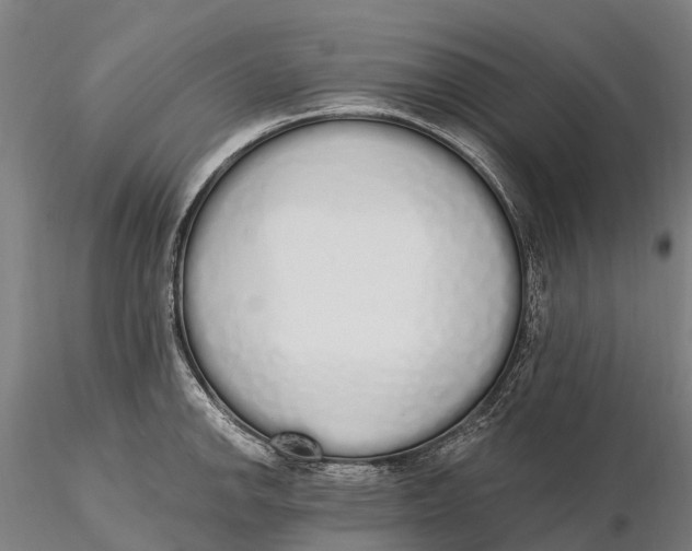 X0000115711142200912031522