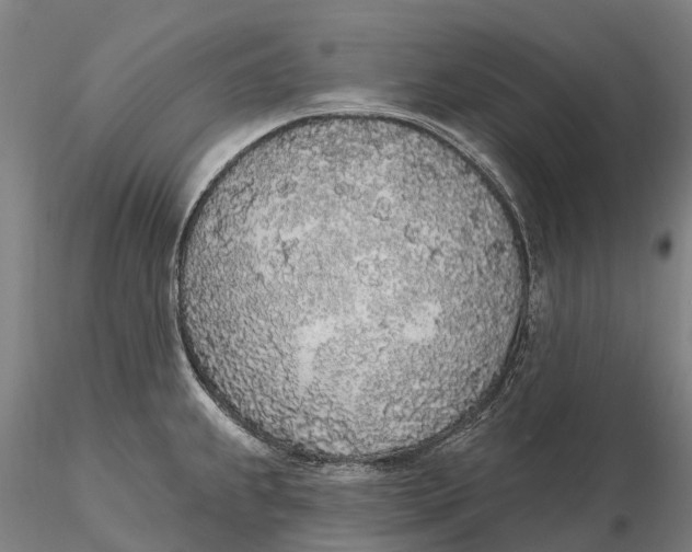 X0000115711239200912031521