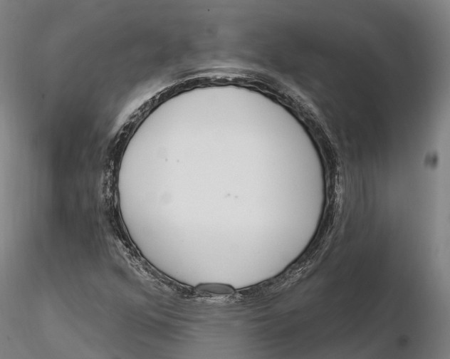 X0000115711352200912031519