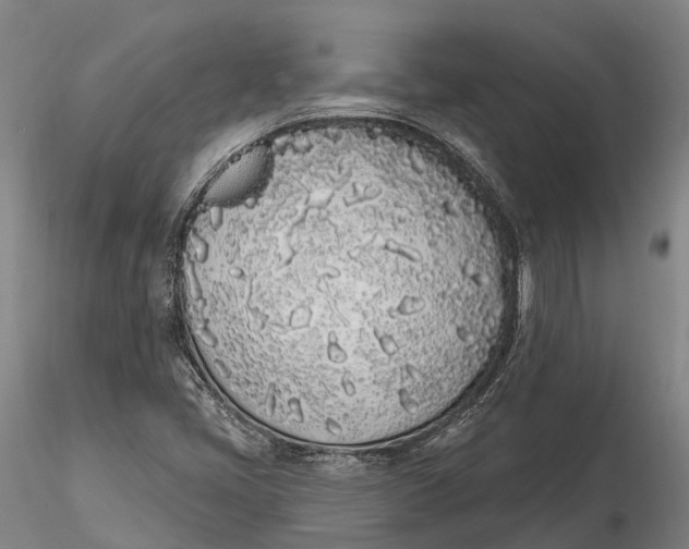 X0000115711405200912031518