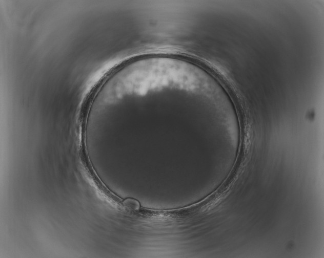 X0000115711414200912031518