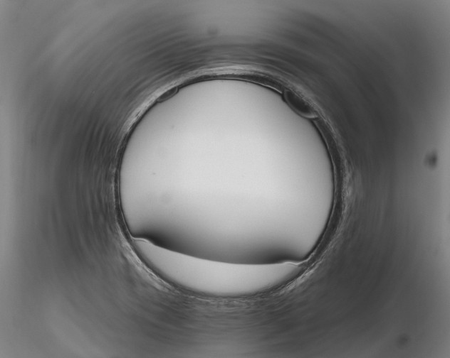 X0000115711417200912031518