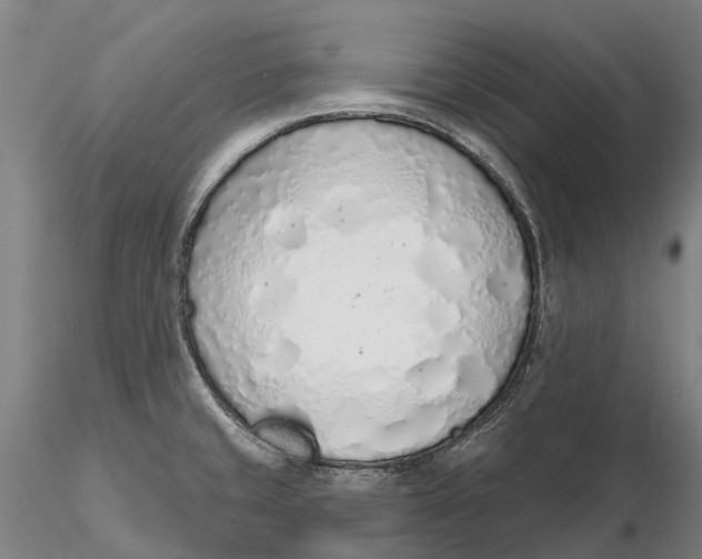 X0000115711429200912031518