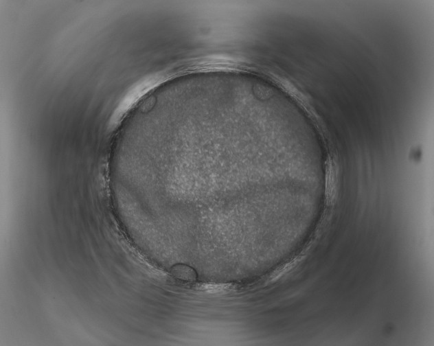 X0000115711453200912031517