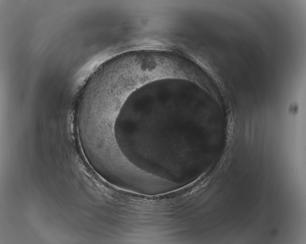 X0000115711455200912031517