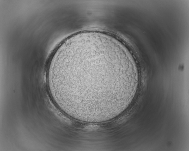 X0000115711462200912031517