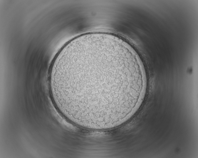 X0000115711470200912031517