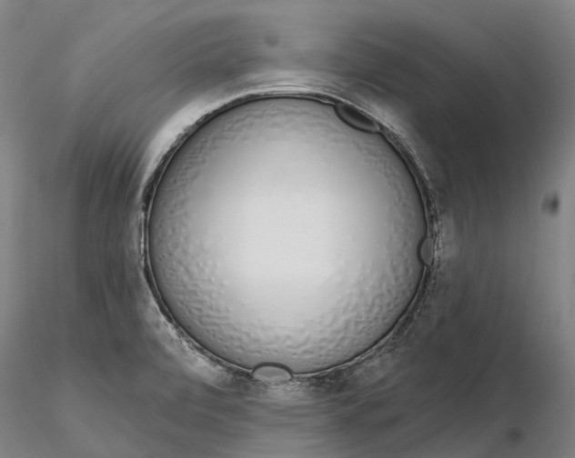 X0000115711472200912031517