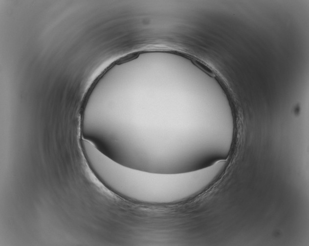 X0000115711476200912031517