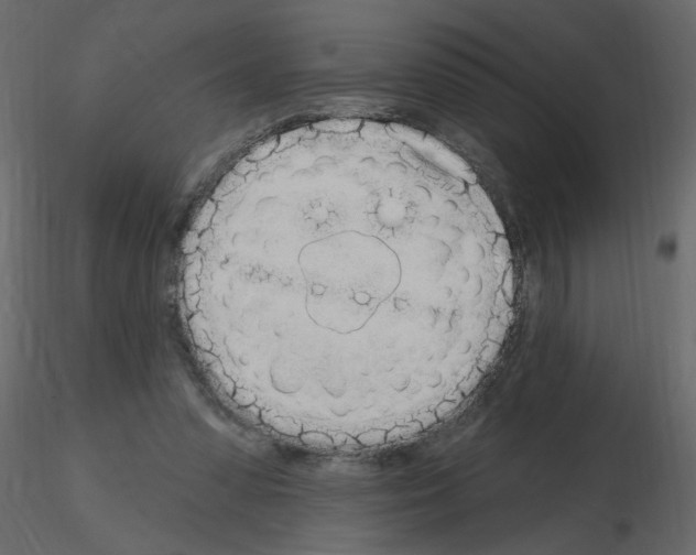 X0000115710303200912241549