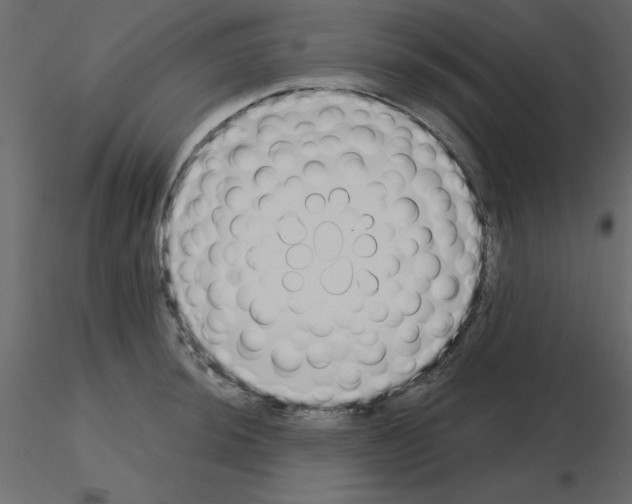 X0000115711044200912241539