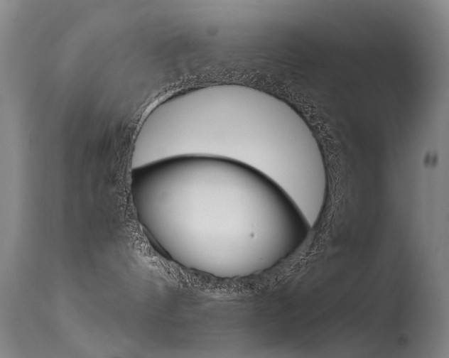 X0000115720144200911121112