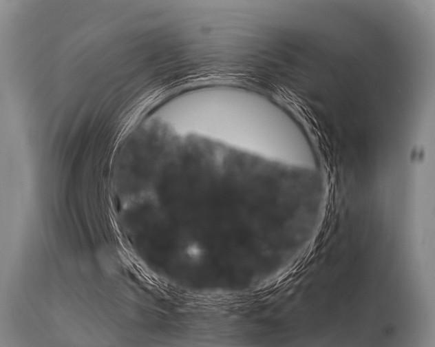 X0000115720145200911121111