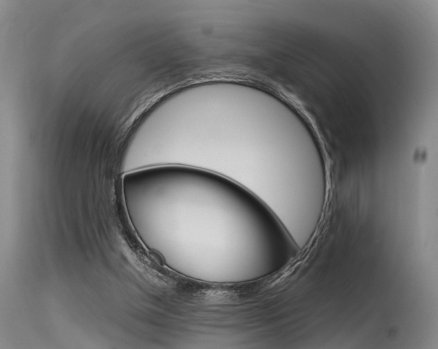 X0000115720154200911121111