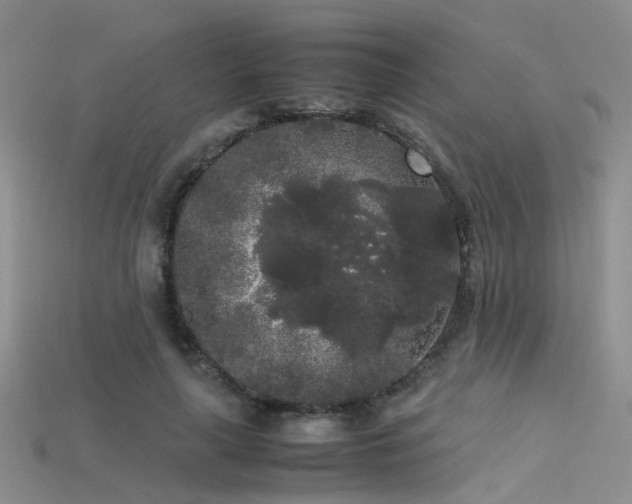 X0000115720643200911121451