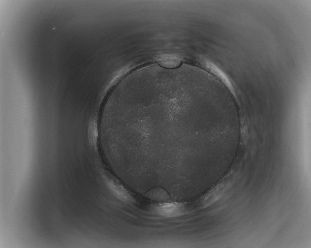 X0000115720059200911191400