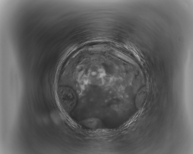 X0000115720145200911191358
