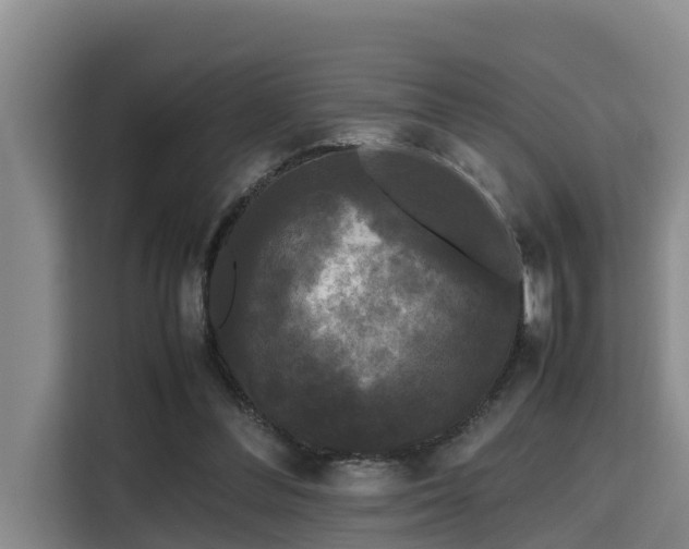 X0000115720300200911191357