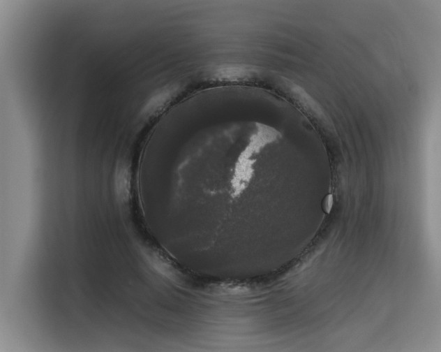 X0000115720640200911191352