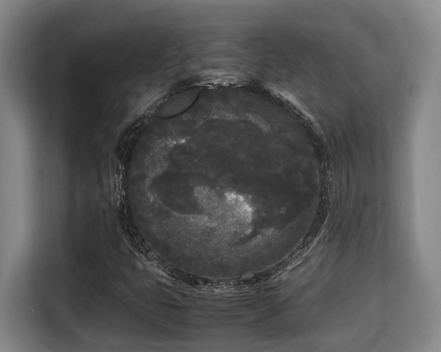 X0000115721399200911191342