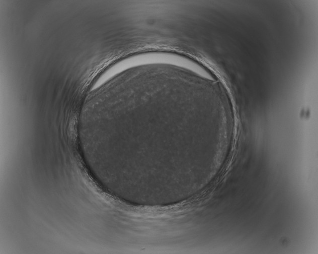 X0000115720009200912031602