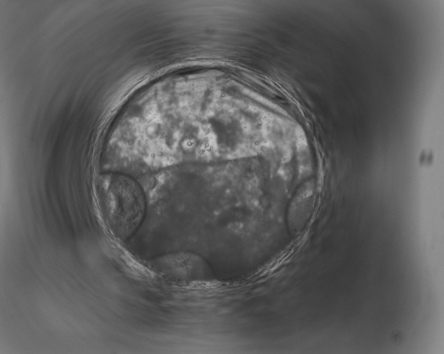 X0000115720145200912031558
