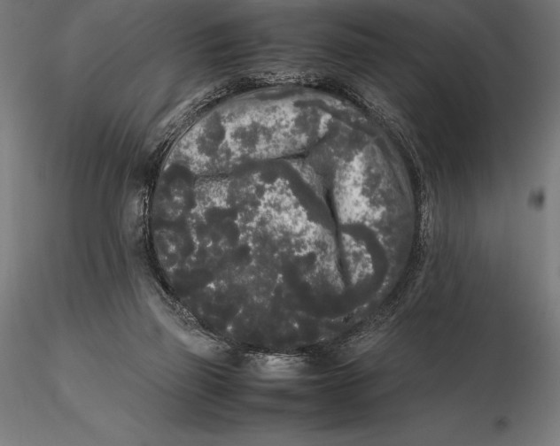 X0000115720165200912031559