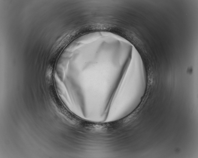 X0000115720166200912031559